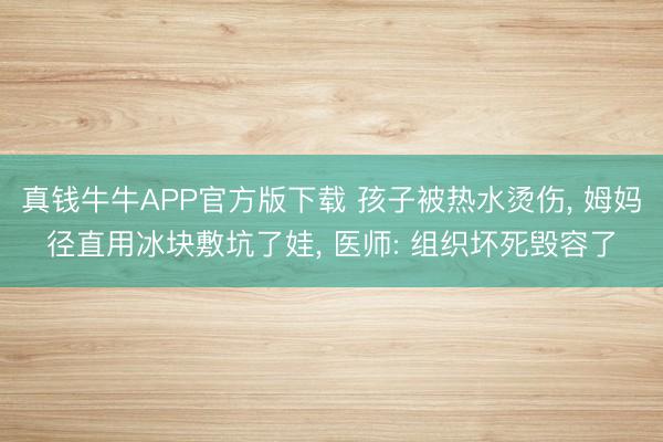 真钱牛牛APP官方版下载 孩子被热水烫伤， 姆妈径直用冰块敷坑了娃， 医师: 组织坏死毁容了